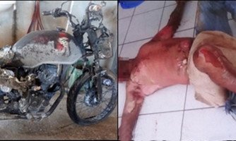 Moto pega fogo após acidente em 4 Marcos; motoqueiro sofreu queimadura de segundo grau
