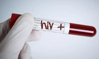 HIV não é motivo para empresa deixar de indenizar