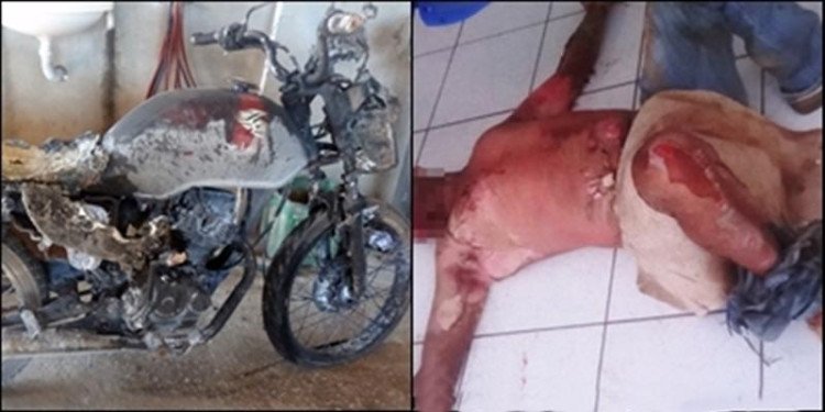 Moto pega fogo após acidente em 4 Marcos; motoqueiro sofreu queimadura de segundo grau