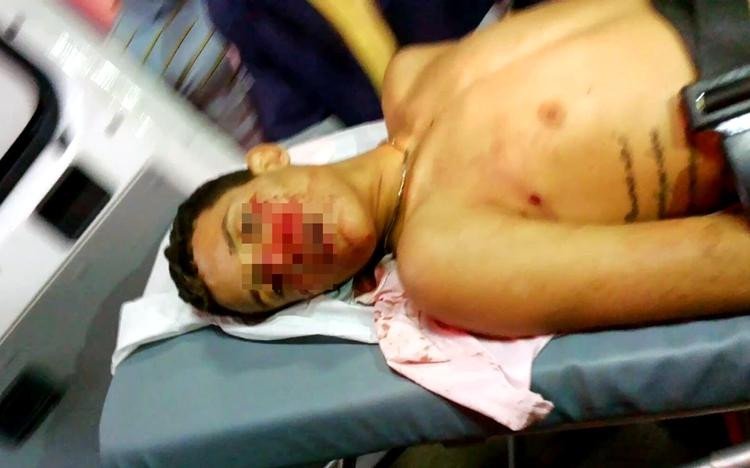 COMPARTILHAMENTO: Projeto prevê multa a quem propagar imagens de mortos