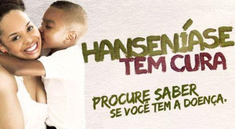 Crianças de 5 a 14 anos são público alvo de campanha contra hanseníase