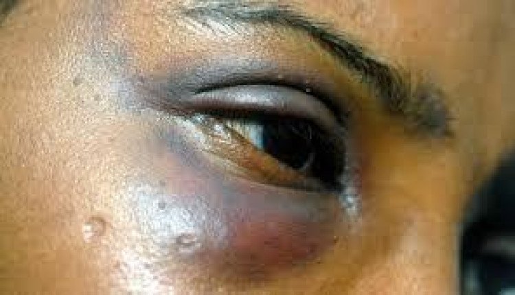 Lei garante cirurgia reparadora para mulheres vitimas de violência