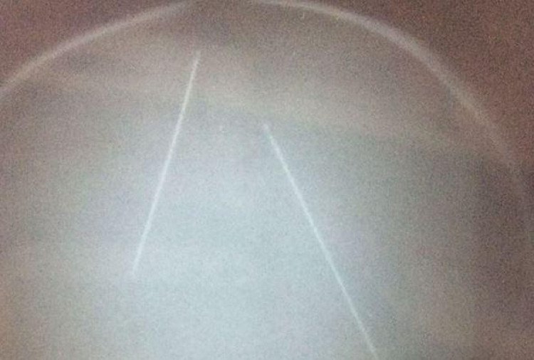 Raio-X mostra agulhas na cabeça de bebê vítima de suposto ritual em MT