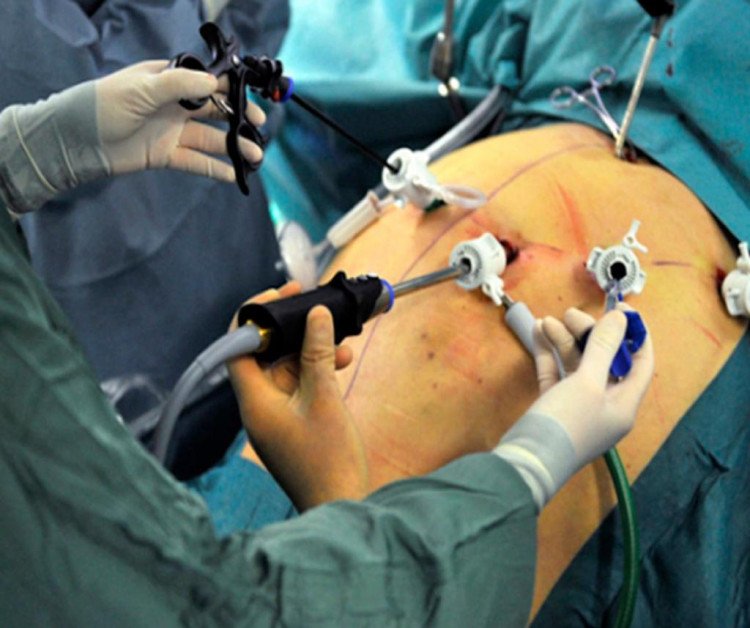 Hospital Metropolitano retoma cirurgias de alta complexidade