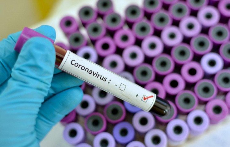 Caso suspeito de Coronavírus em Araputanga  é investigado pela Secretaria de Saúde de MT