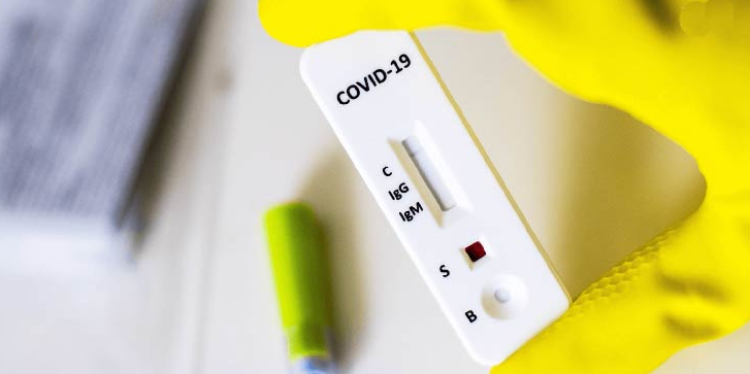 TESTES PARA COVID: Quatro Marcos e mais 14 municípios serão contemplados com coleta de exames através de  parcerias entre Unemat, MPT e TRT