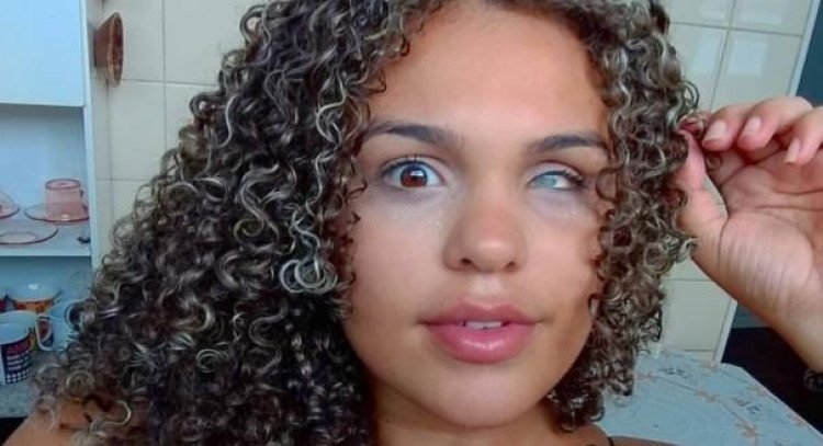 Bolsonaro sanciona lei que define visão monocular como deficiência