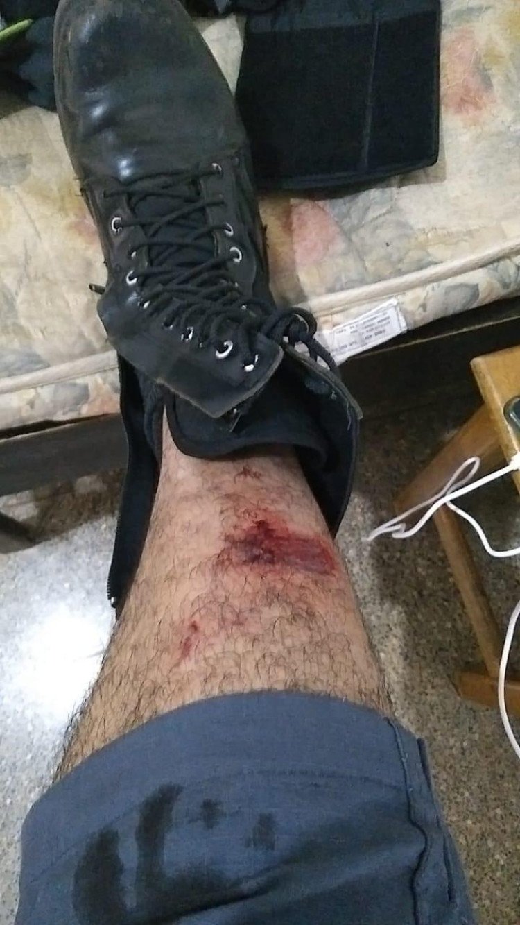 Homem é preso após atropelar policial militar em Curvelândia