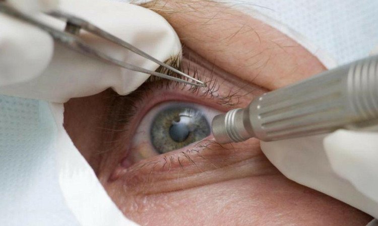 Pandemia impede realização de mais de 1 milhão de cirurgias em um ano