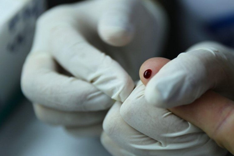 Incidência de hepatite aguda grave ´é monitorada pelo Ministério da Saude