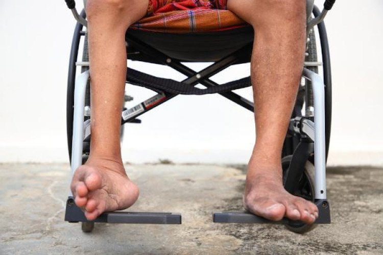 Após 34 anos sem poliomielite, baixo índice de vacinação preocupa